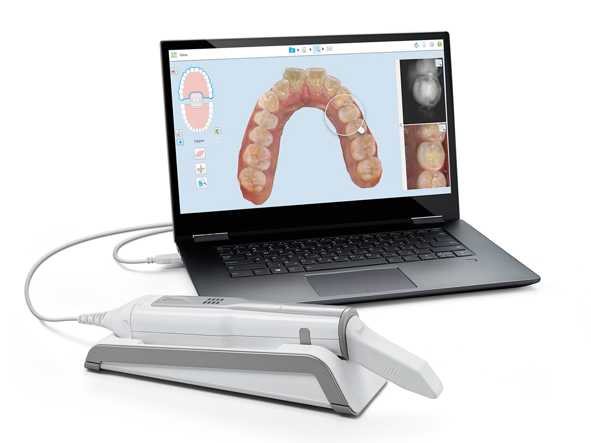 FDA OKs Align Technology s Itero Element 5D Dental Scanner 2020 03 25 