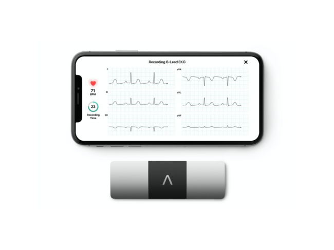 Kardiamobile 6L device and mobile app