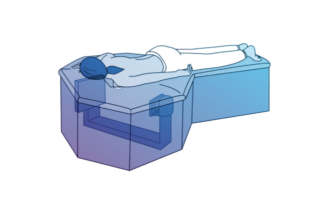 Artist’s rendering of patient lying on Izotropic’s 3D breast CT scanning platform