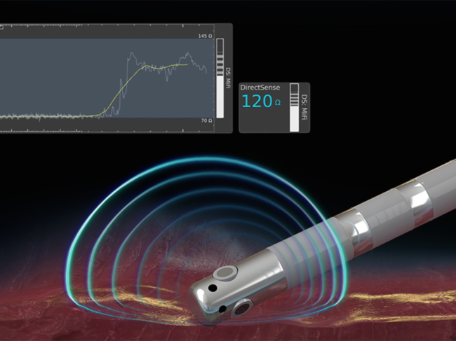 Illustration of local impedance field on tissue being monitored during ablation