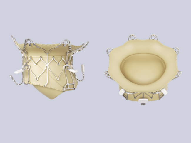 Side and top view of Epygon valve