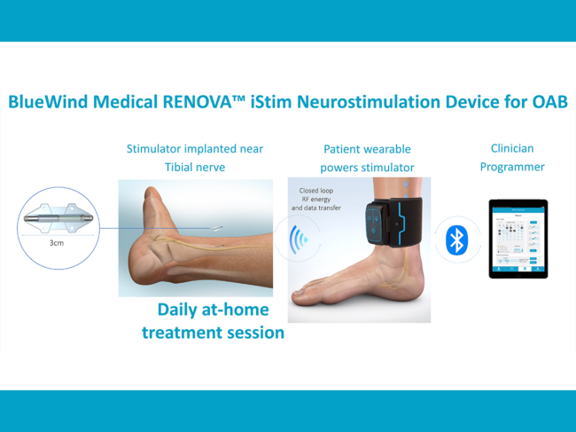 Diagram illustrating Renova system components