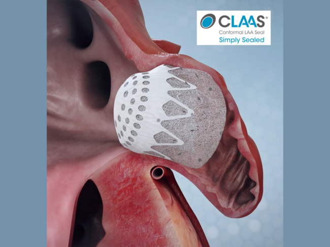 Illustration of CLAAS in heart