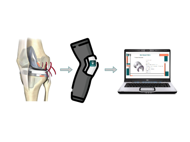 Diagram showing how Bonetag works