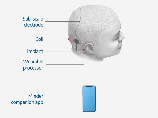 Diagram of device components