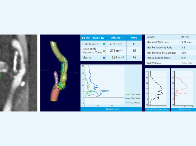 CT scan vs. software screenshot