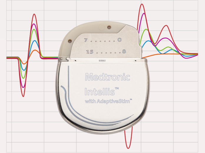 Closed-Loop Technology Significantly Helps Some Back Pain Sufferers –  Consult QD