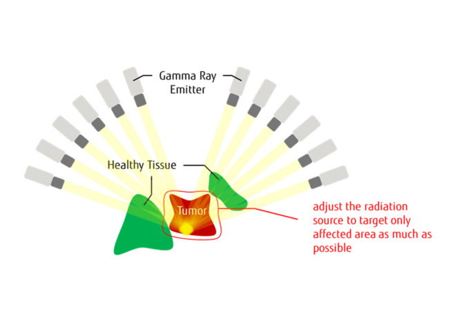 Illustration of gamma rays targeting tumor