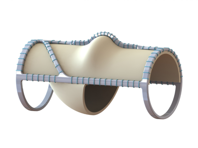 Venovalve product rendering