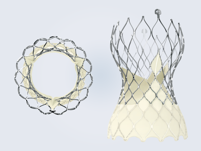 Get SMART: Medtronic’s Evolut TAVR outperforms Edwards Sapien in trial ...