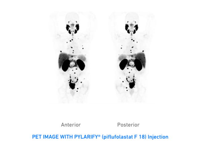 PET imaging with Pylarify
