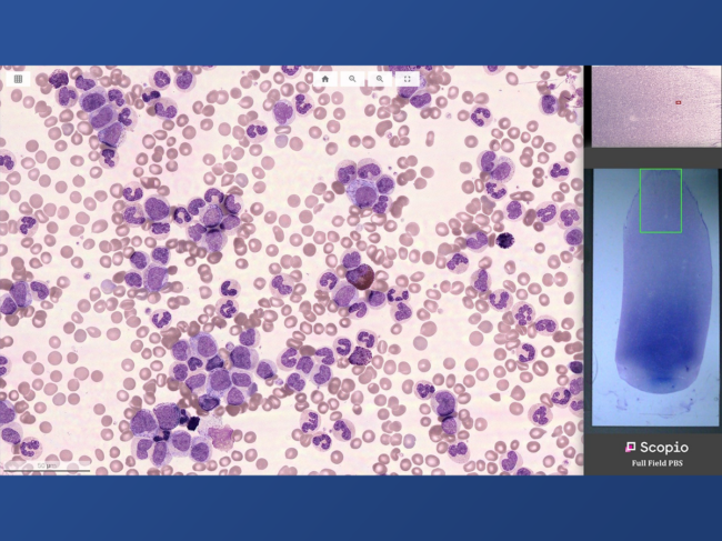 Scopio's digital blood smear analysis tool