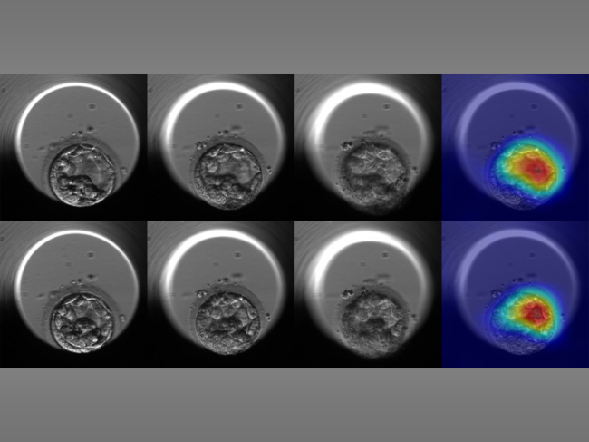 Embryo evaluation