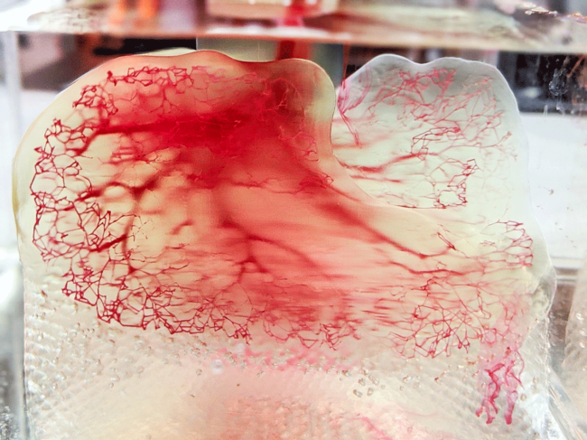 Image of human vasculature model