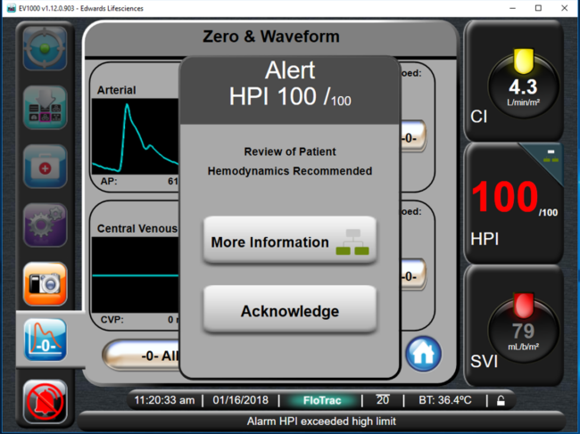 Acumen HPI software screenshot