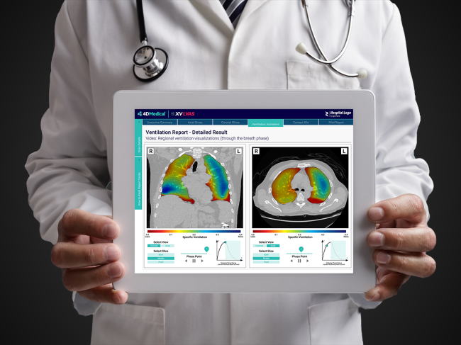 Doctor holding tablet with 4dmedical software