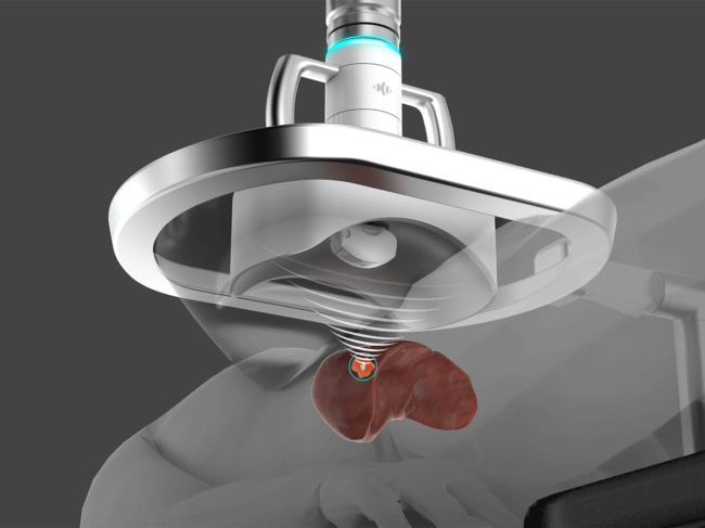 Rendering of histotripsy treatment head and targeted destruction of liver tissue