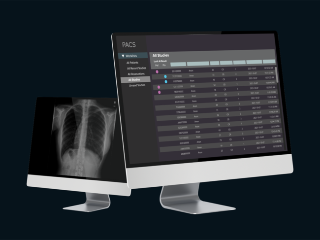 Computer monitors displaying Lunit Insight CXR Triage software