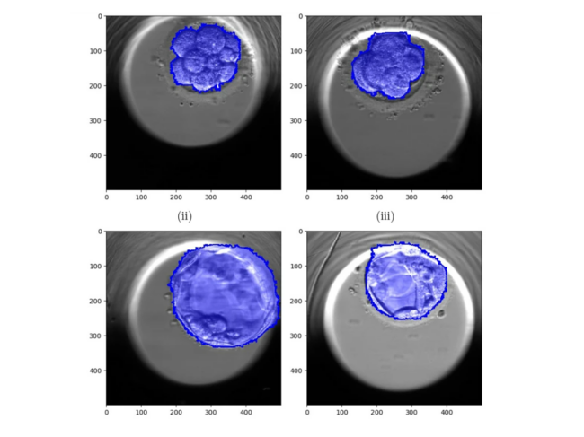 CHLOE system images showing various blastocyst development