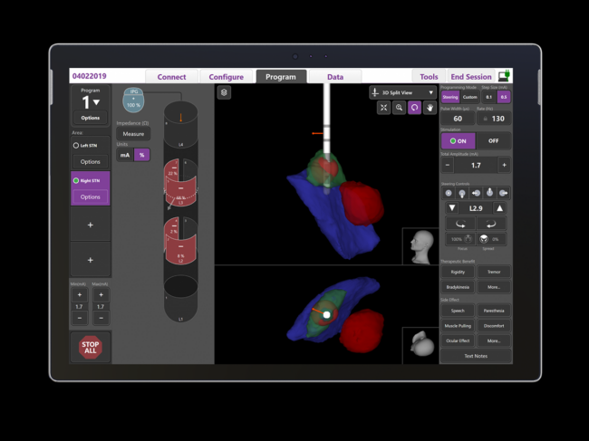 Vercise Neural Navigator with Stimview XT software on tablet