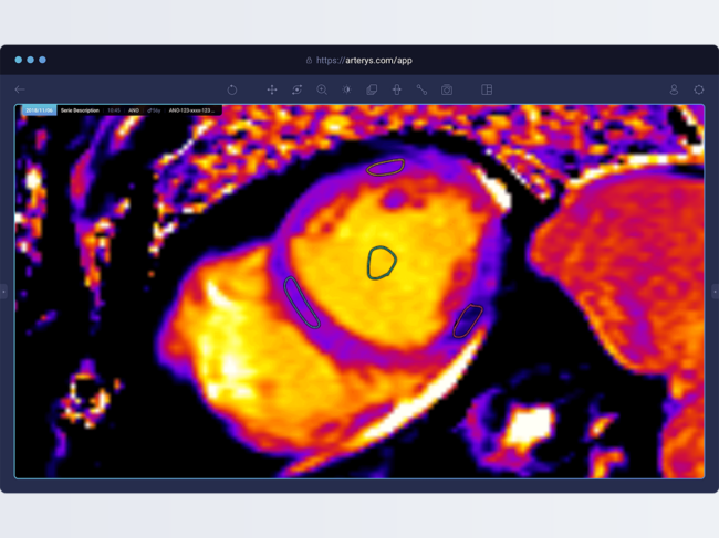 Cardio AI software