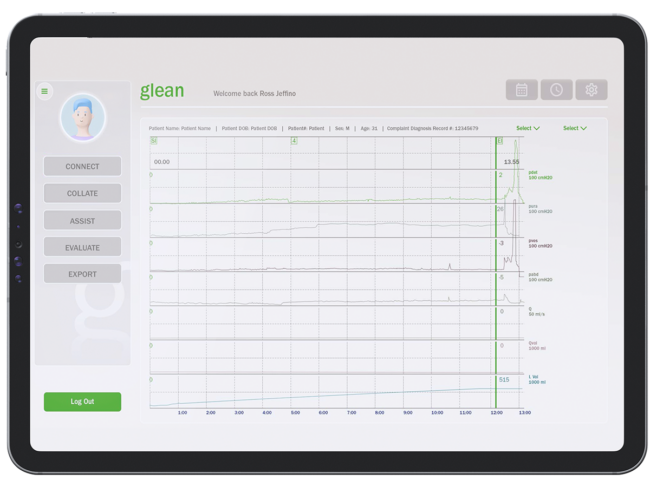 Bright Uro Glean system featured