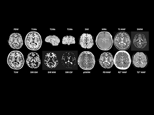 Spintech MRI