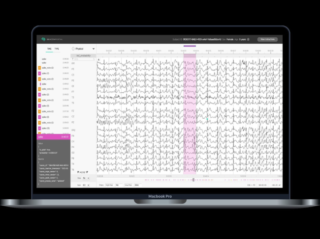 Laptop displaying Beacon Biosignals software