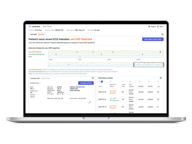 Anumana ECG-AI platform