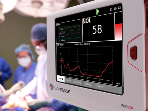 Medasense pmd 200 nol monitoring