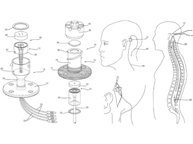 neurochase port