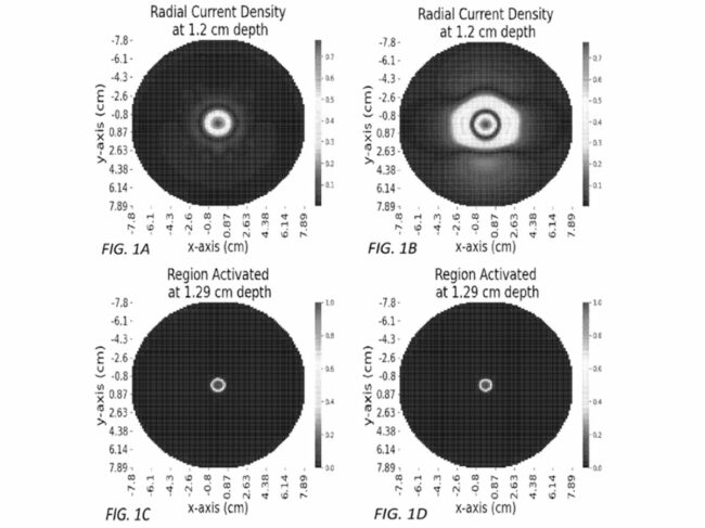 transcranial electrode placement