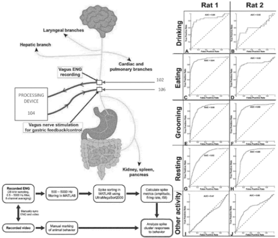 vagus nerve stimulation for weight loss