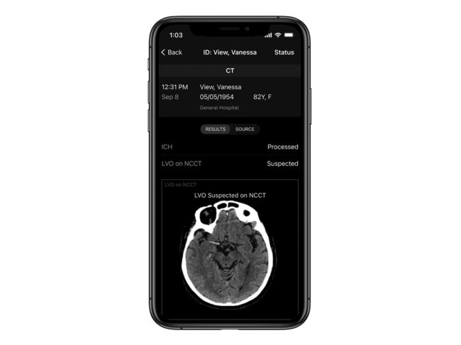 Rapidai NCCT Stroke solution