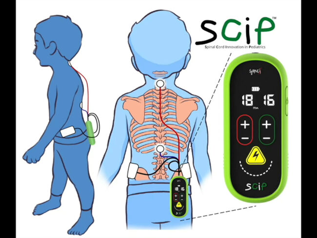 Spinex SCIP