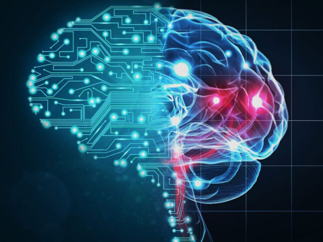 Brain with stroke illustration