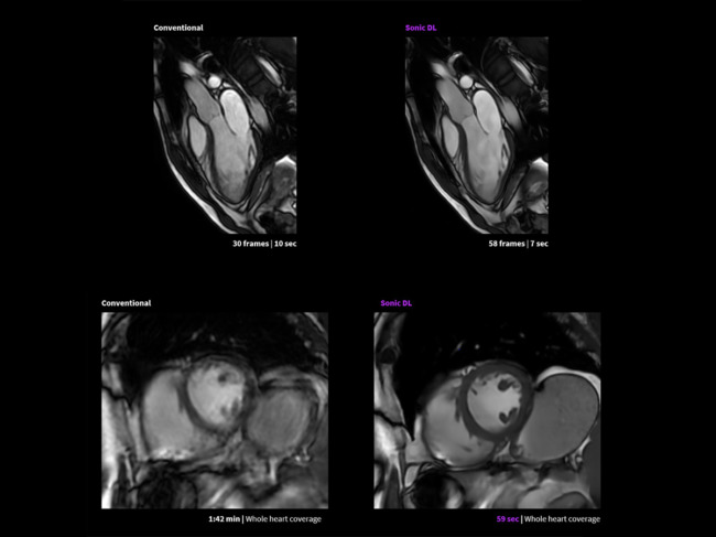 Sonic DL imaging vs. conventional