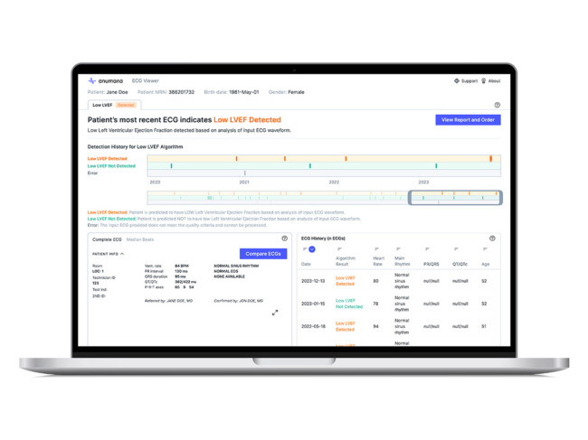 Anumana ECG-AI platform