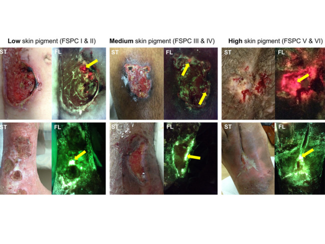 Moleculight-fluorescence-imaging.jpg