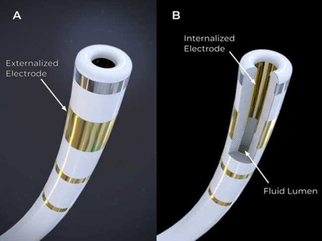 FieldForce Catheter