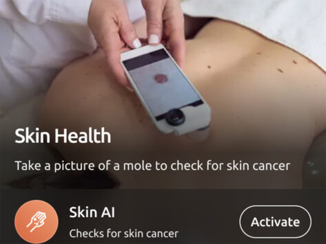 Helfie skin cancer 30aug24