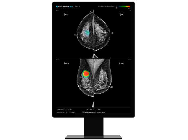 Lunit INSIGHT MMG