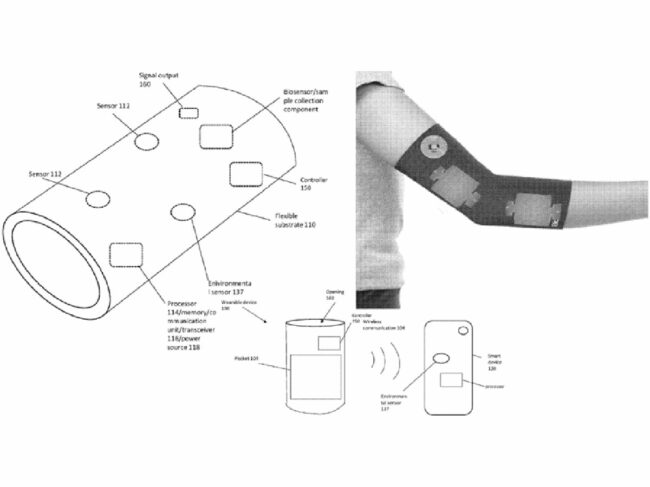 Nobel compression sleeve