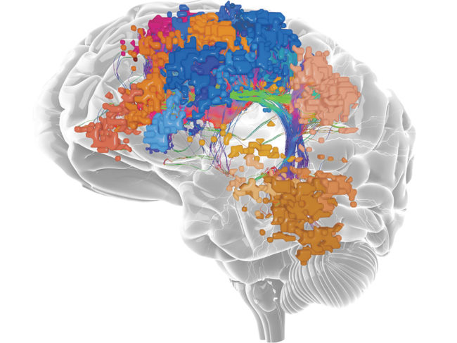 Omniscient brain map