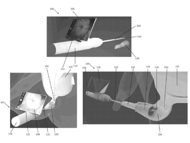 Ciconia cervical measurement device