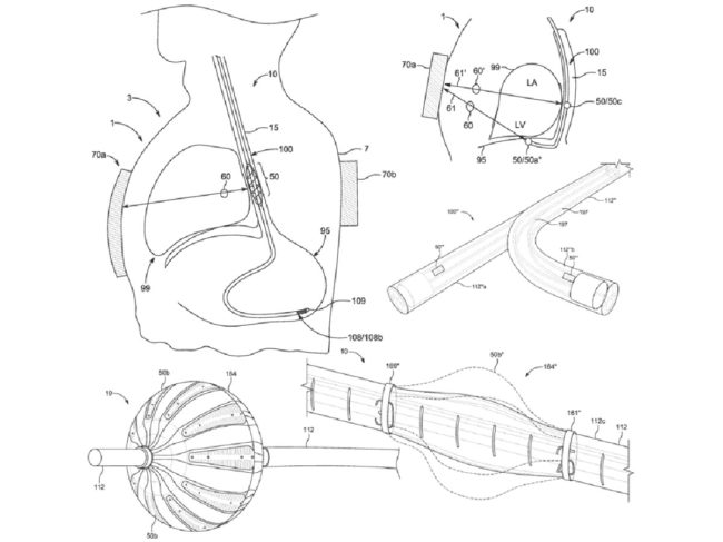 Endeavor esophageal cardiac pacer