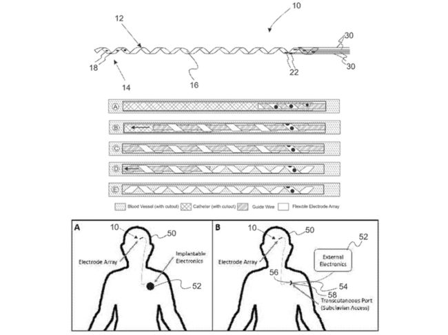 “Thin film endovascular electrode array and method of fabrication.”
