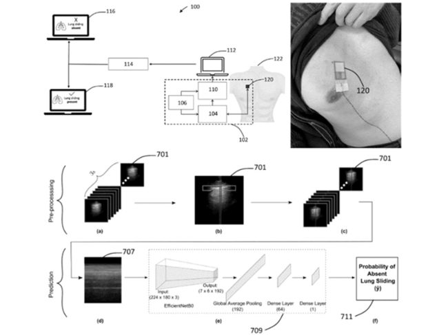 deep breath ultrasound