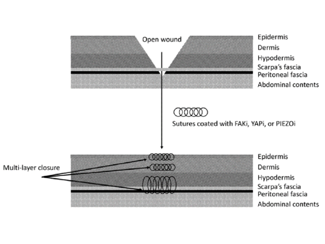 suture coating