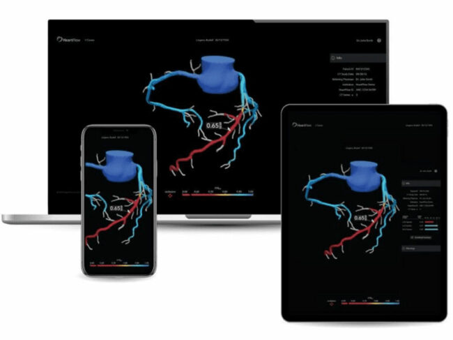 heartflow-diagnostic-8may24.jpg